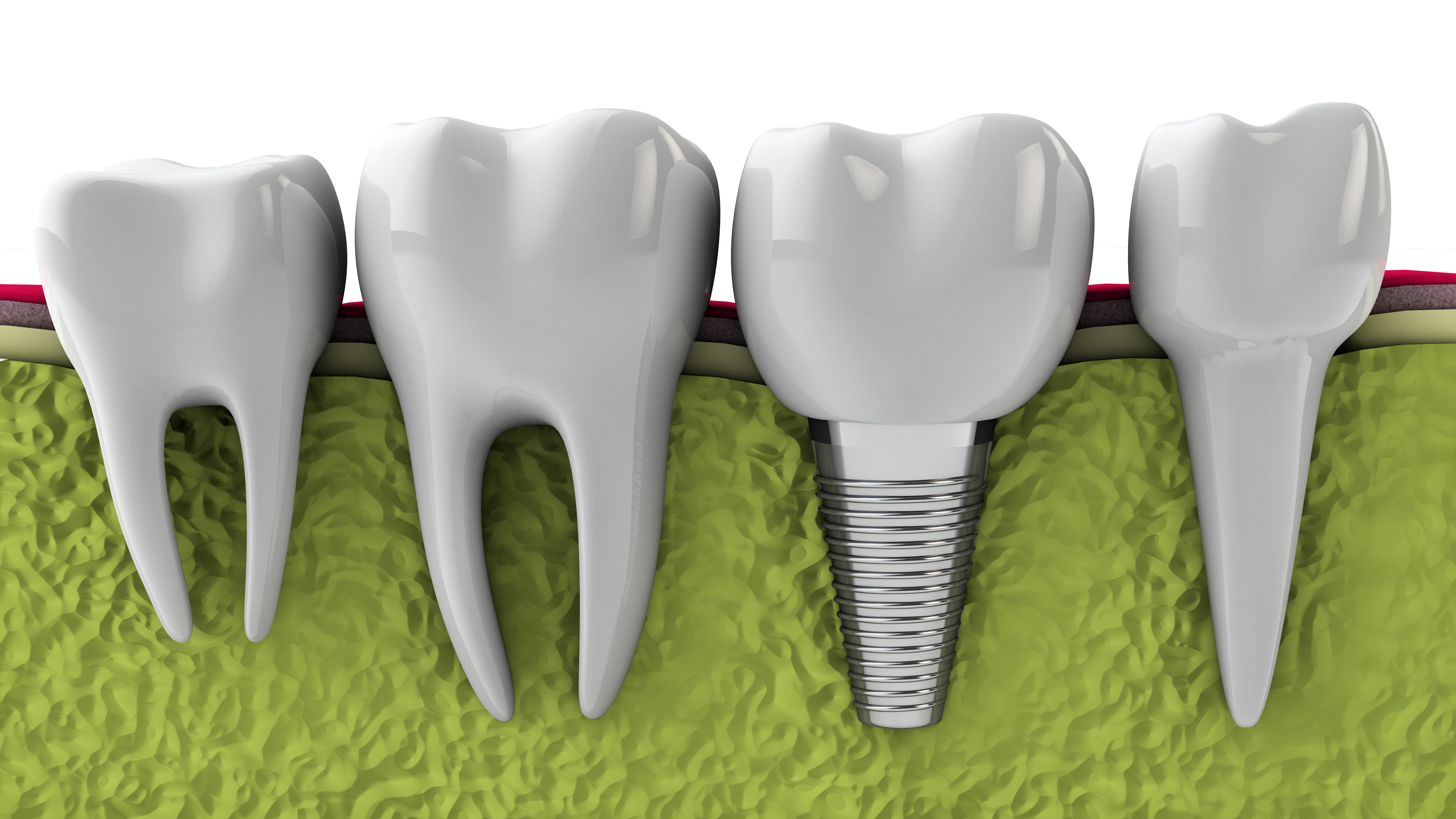 Dental Xperts Image