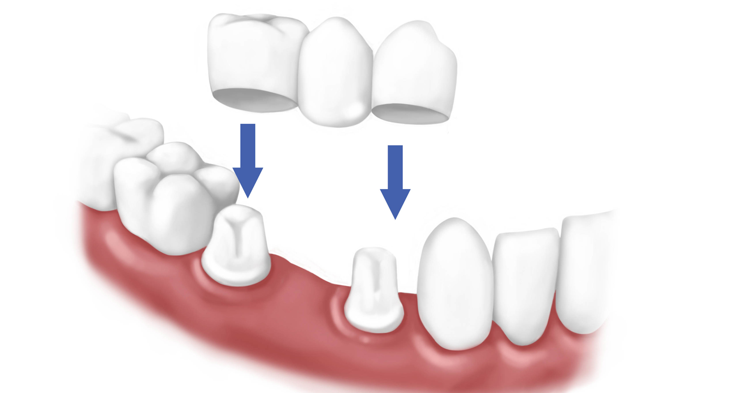 Dental Xperts Image