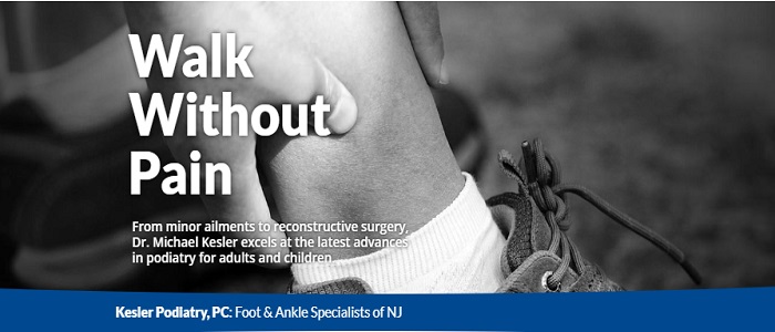 Plantar Fasciitis Image