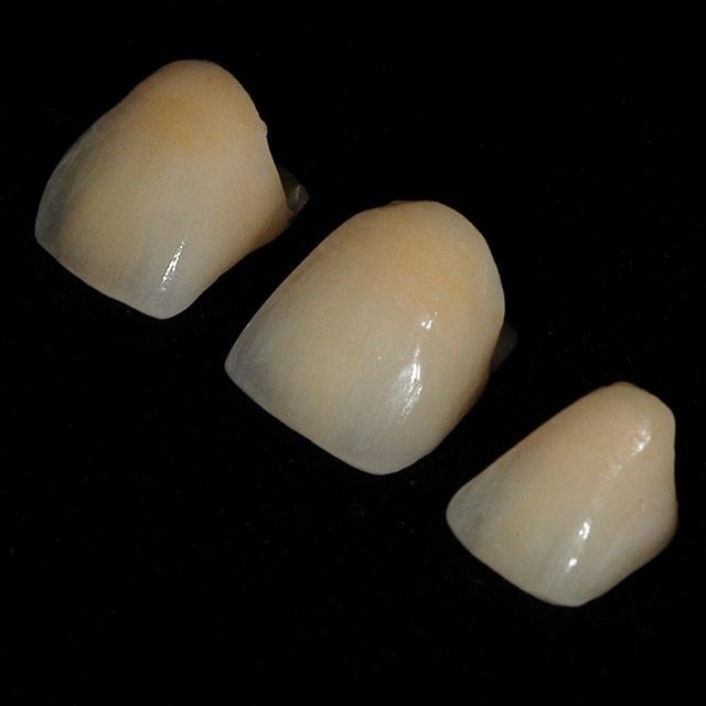 Dental Crowns Lab Image