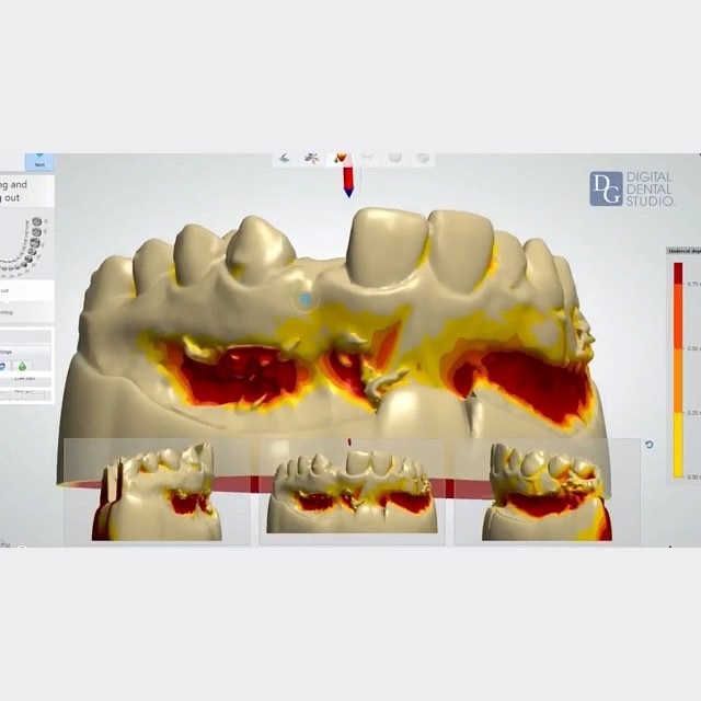 Dental Crowns Lab Image