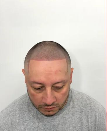 SMP SNIPZ MIAMI Image