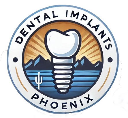 Dental Implants Phoenix Logo