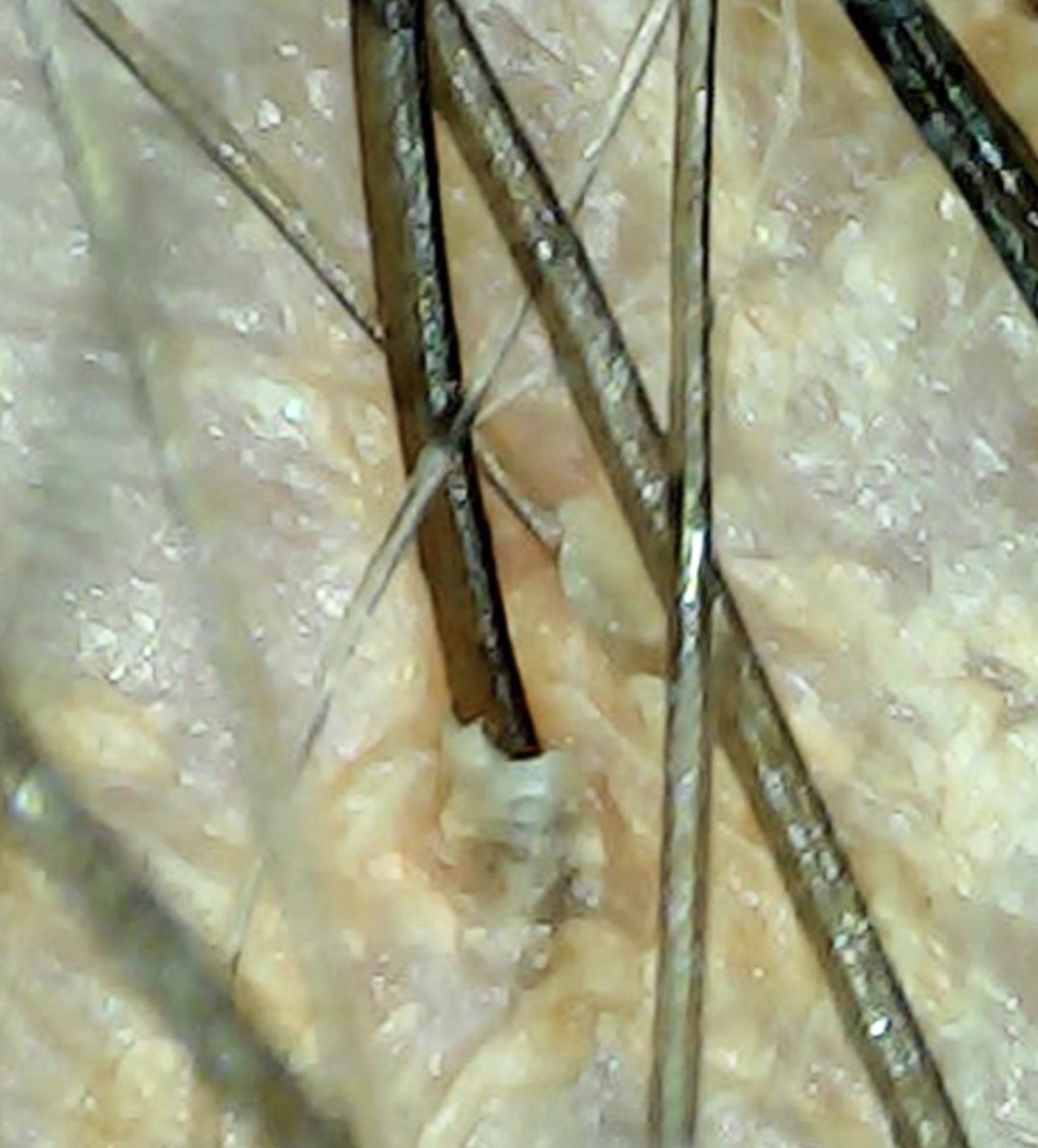 Rejuvenated Roots Head Spa Image